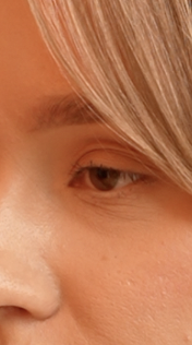 Reference image 1