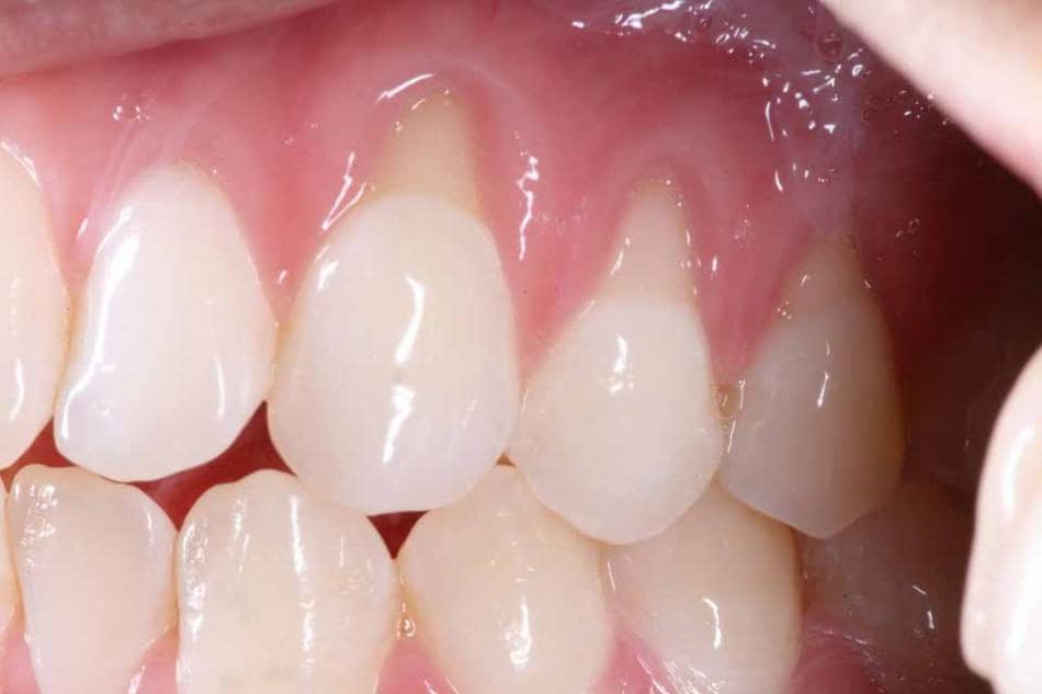 Reference image 1