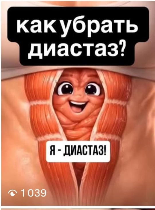 живот_диастаз.jpg